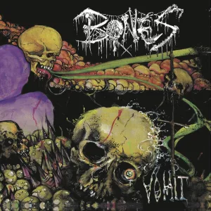 Vomit