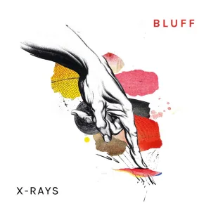 X-Rays