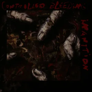 Somnambulation