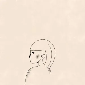 Scars