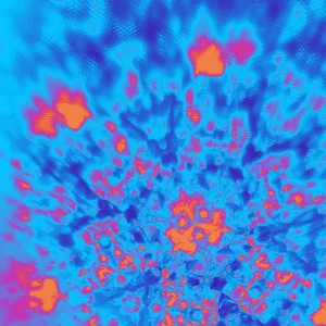 fractal cataracts