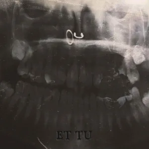 gut me