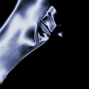 Phantasy (CASSIMM Remix)
